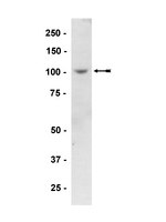 Anti-pkd2 Antibody 